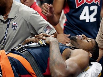 保罗·乔治训练赛小腿90度掰断