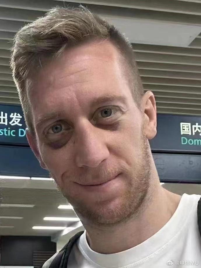 记者晒照贝里奇近况：熊猫眼明显
