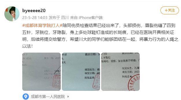 网友爆料成都体院与川大足球赛冲突，川大球员被踩脸&鲜血满面！