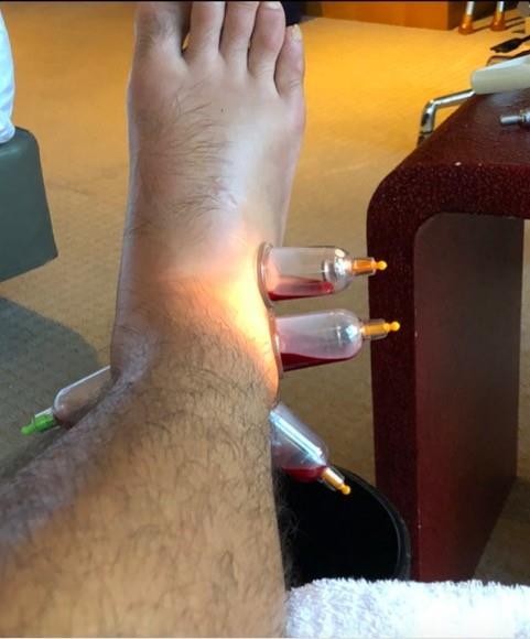 张玉宁戴伟浚相互鼓励，受伤部位是18年亚运老伤