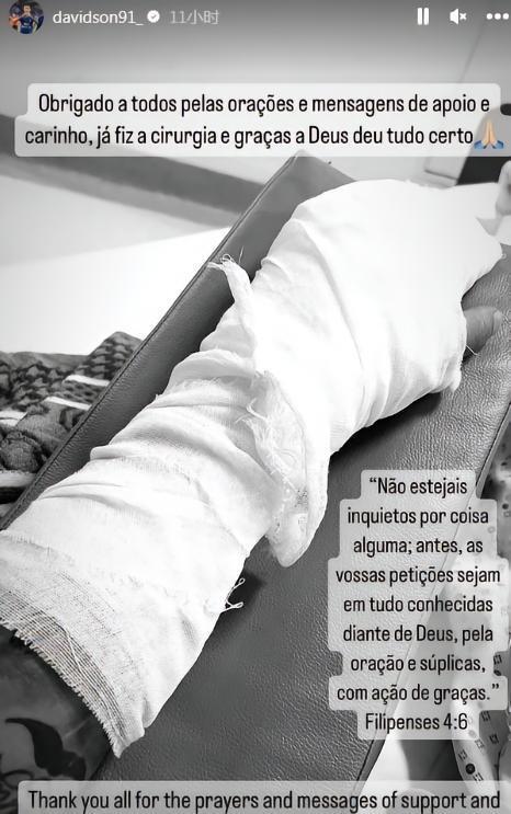 戴维森：我已经顺利完成左手手术，感谢大家的支持和关心