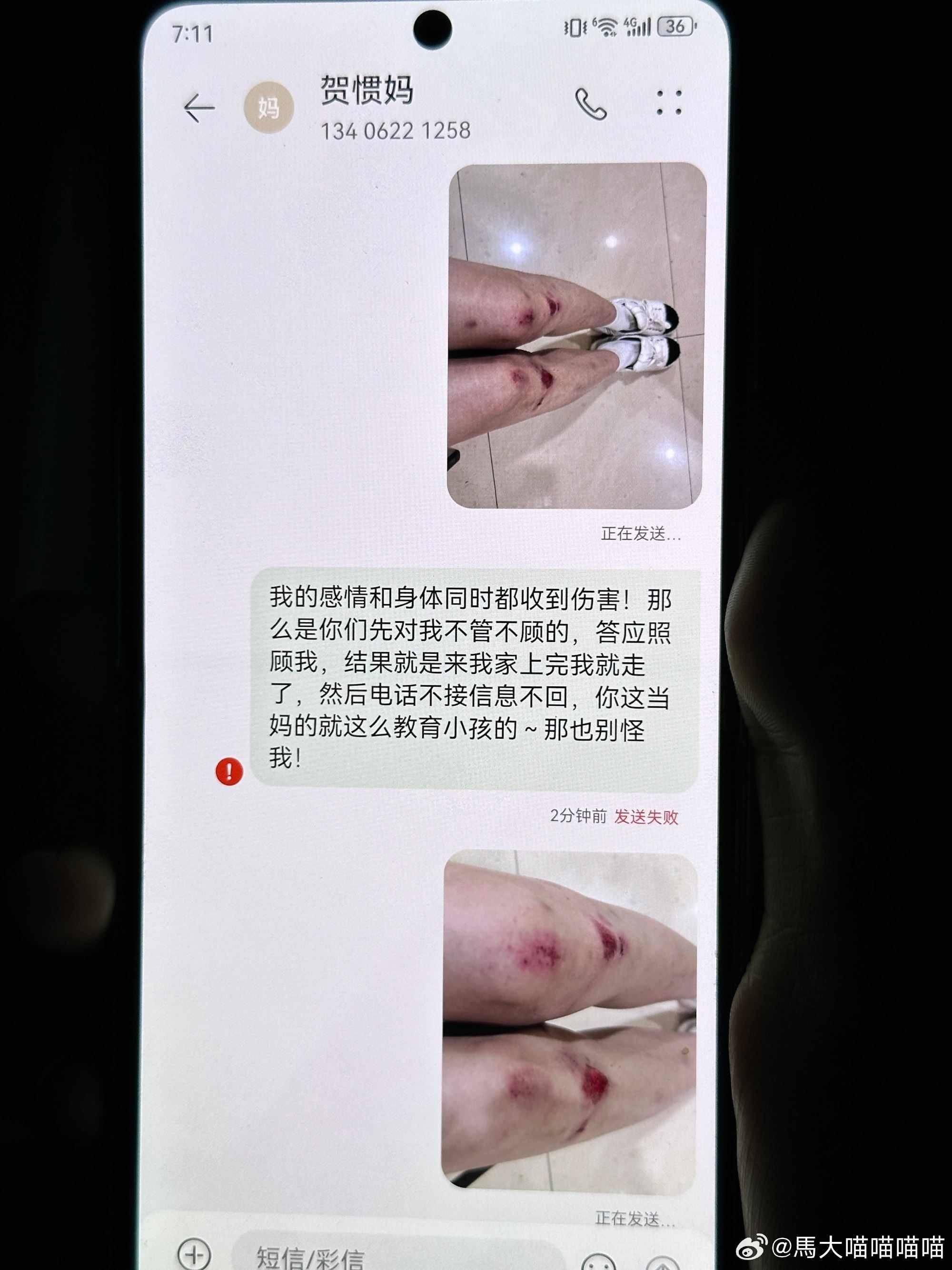 女子再晒受伤照喷贺惯母子：每次说的很好听，但每次都是欺骗