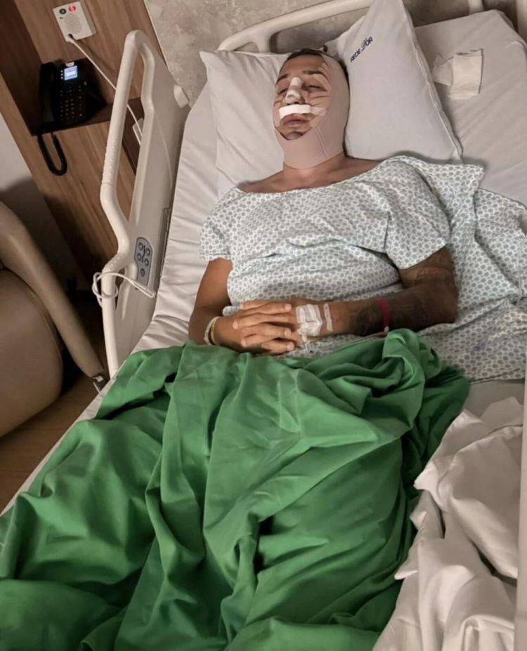 记者：西海岸外援戴维森已接受鼻梁手术 7月受伤起便一直保守治疗