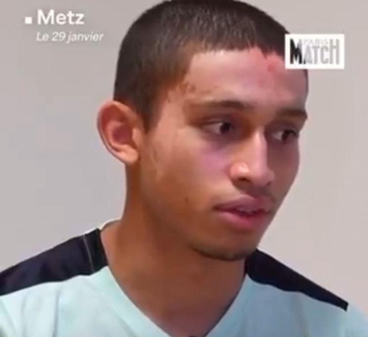 梅斯19岁小将与女友度假被严重烧伤：现在没法想足球，只想康复好