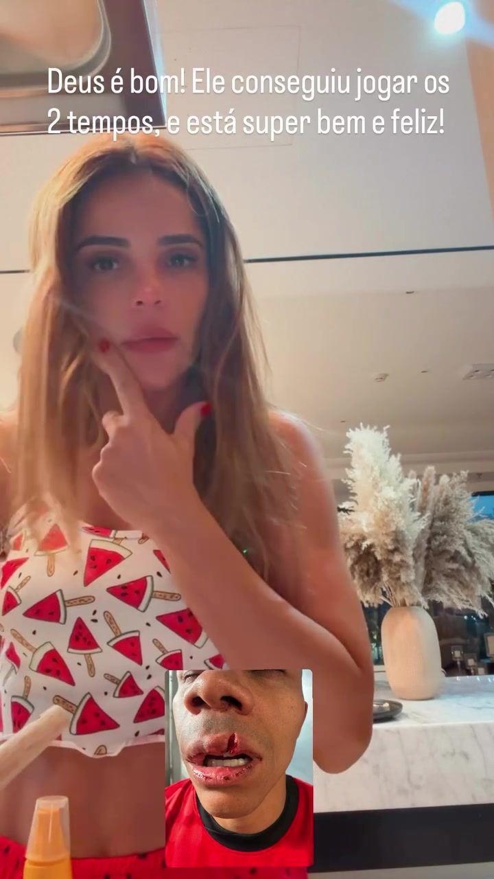 遭肘击！牙医妻子：韦林顿嘴唇裂开缝了15针 牙齿移位 只能吃流食