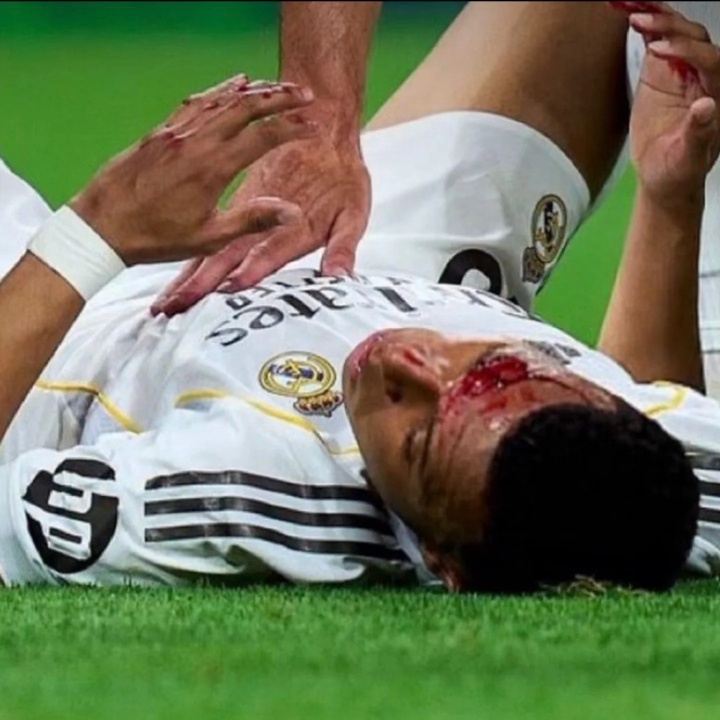 龙赛罗晒姆巴佩流血照：这就是西班牙裁判，内格雷拉仍在操控一切