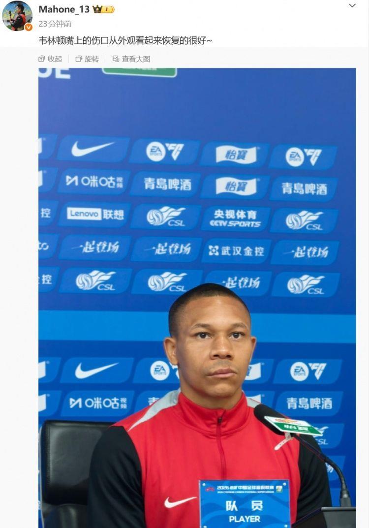 博主：韦林顿嘴上的伤口，从外观看起来恢复的很好